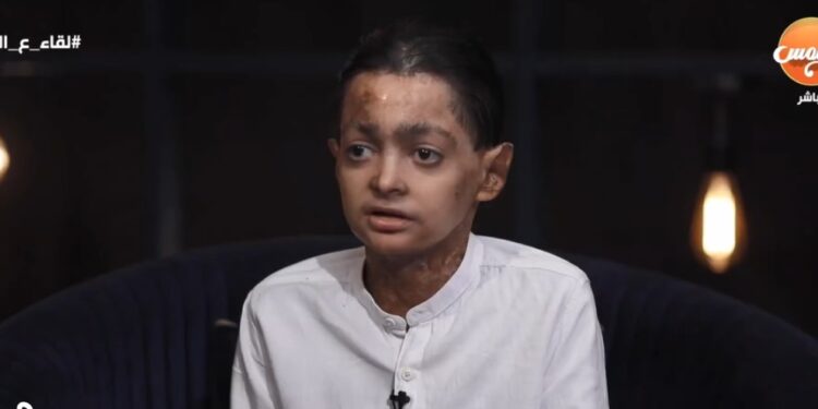 قصة شاب أصيب بمرض مناعي نادر يصيب 3 أشخاص من كل مليون في العالم.. تفاصيل مؤثرة