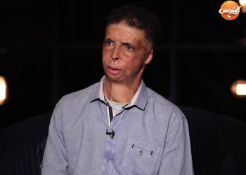 تعرض للحرق وأخفى نفسه عن الناس.. تعرف على قصة وائل عوكل؟
