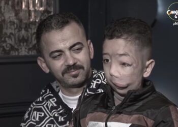 نفسي ابني يرجع كويس والد محمد: ابني مش بيحب يروح المدرسة بسبب خوف الأطفال.. تفاصيل 