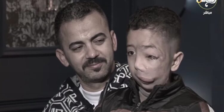 نفسي ابني يرجع كويس والد محمد: ابني مش بيحب يروح المدرسة بسبب خوف الأطفال.. تفاصيل