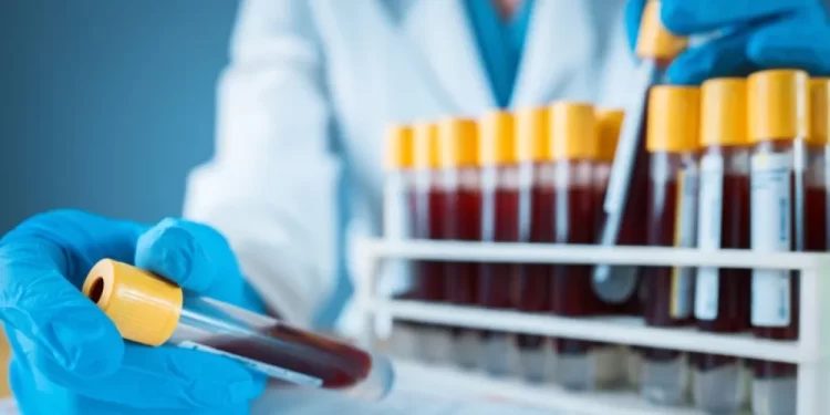 جهات التحقيق تخلي سبيل طبيبة تحاليل الـ DNA بكفالة 10 آلاف جنيهًا