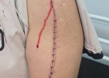 تفاصيل اعتداء بلطجي على موظف بمطواة أمام مسجد في حلوان