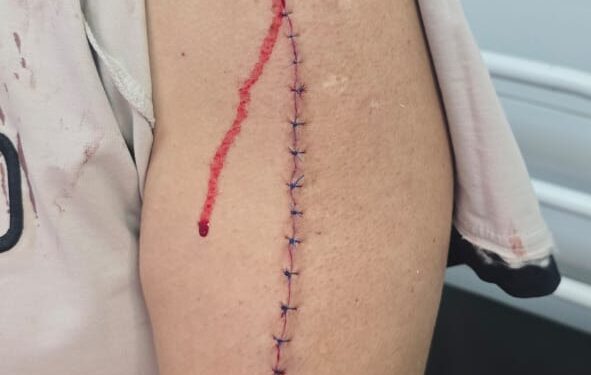 تفاصيل اعتداء بلطجي على موظف بمطواة أمام مسجد في حلوان