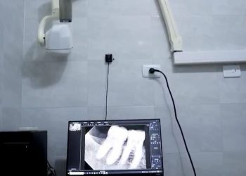 صحة الغربية تطلق مبادرة متخصصة لخدمات طب الأسنان لذوي الهمم في زفتى والمحلة