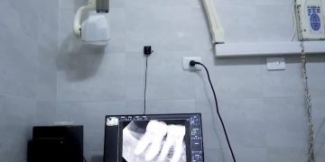 صحة الغربية تطلق مبادرة متخصصة لخدمات طب الأسنان لذوي الهمم في زفتى والمحلة