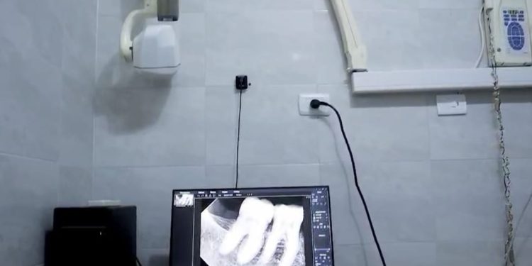 صحة الغربية تطلق مبادرة متخصصة لخدمات طب الأسنان لذوي الهمم في زفتى والمحلة