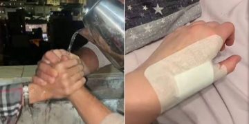 “اتقوا الله في أنفسكم”.. تحذير عاجل من مؤسسة “أهل مصر” بشأن تريند “الشاي المغلي”